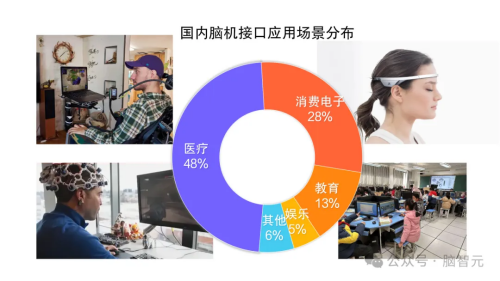 行业风口已至：突破脑机接口发展技术“瓶颈”及产业“困境”